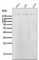 Anti-ErbB2 (HER2) Monoclonal Antibody